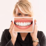 HOLLYWOOD SMILE